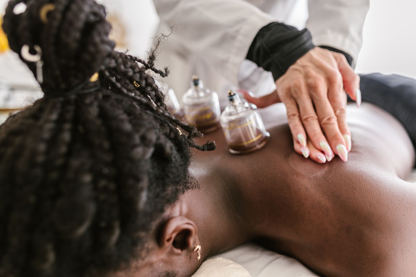 Cupping therapy — cups resting on a client's upper back